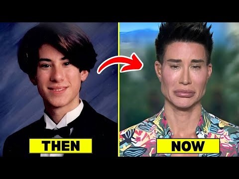 15 Shocking Male Celebrities’ Plastic Surgery Transformations | Then and Now 2026