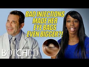 Myesha Had Bootleg Filler Injected Under Her EYES?! (Before & After) | Botched | E!