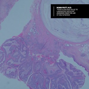 How can AI add value to laboratory medicine? Listen to this episode of “Answers From the Lab,” as Bobbi Pritt, M.D., chair of the Department of Laboratory Medicine and Pathology at Mayo Clinic, and Bill Morice, M.D., Ph.D., CEO and president of Mayo Clinic Laboratories, discuss examples of AI applications within Mayo Clinic Laboratories. https://bit.ly/409qin4 | Mayo Clinic Laboratories