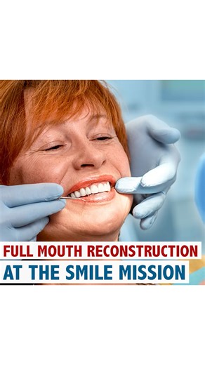 The Smile Mission on Instagram: "🇺🇸 Full Mouth Reconstruction at The Smile Mission 🙌 At The Smile Mission we thrive to give you the best smile. We will take care of your oral health with our professional team to complete your smile! 😁 ✅ Free consultation ✅ The most affordable prices ✅ 10/10 Quality Our clients are happy with our service, so what are you waiting for? 😉 ▶️ Invest in your smile because you are going to be wearing it everyday! 🇪🇸 Reconstrucción bucal completa en The Smile Mis