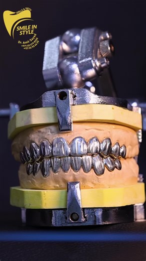 Luxury Grillz: Perfect Fit and Comfort for You