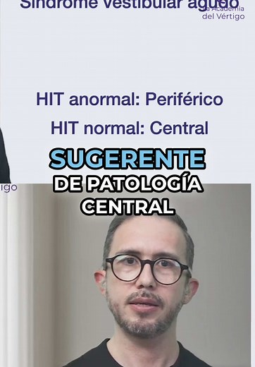 Interpretando el Impulso Cefálico en el Vértigo