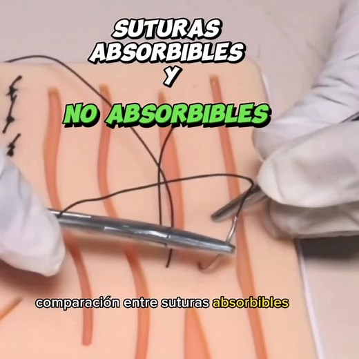 suturas absorbibles y no absorbibles #suturas #tecnicasdesutura #enfermeria #medicina