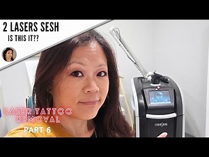 4th Microblading laser removal session: Using 2 lasers-Part 6