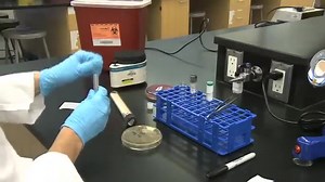 Novobiocin resistance test 😲❤️🔬 #lablife #Microbiology #medicallaboratory | Lab life
