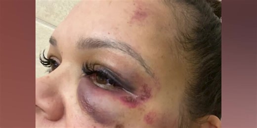 Pregnant woman attacked with a baseball bat while leaving work