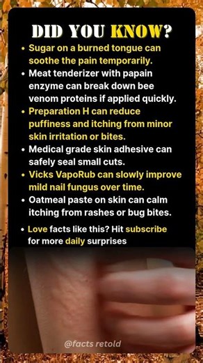 Crazy But Real Home Remedies You Need to Know!