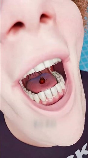 What Happens If You Swallow a Tick 😱🦠