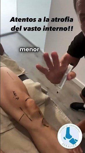 Knee Injuries: The Key to Recovery and Prevention with the Vastus Medialis #fyp #viral #foryou