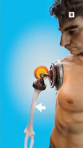 How Doctors Rebuild a Hand Using Gears and Wires After an Amputation 😱