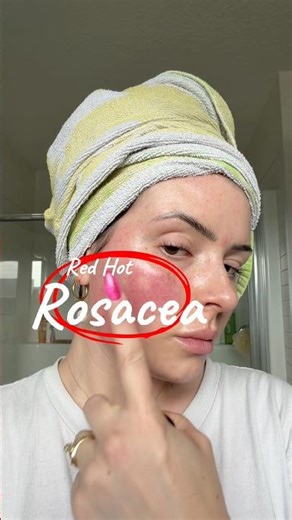 Red Hot Rosacea Flareup