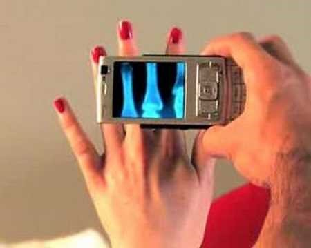 Mobile Xray Scanner - New High Res Video