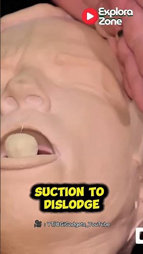 The Anti-Choking Device