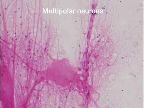 Multipolar neurons under light microscope.