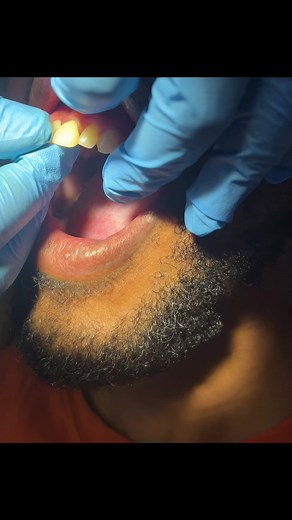 DrKLModibaDentalStudio on TikTok