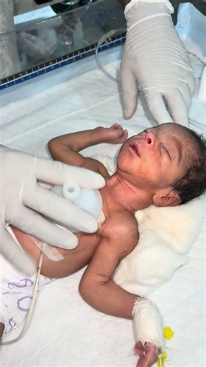 Chestryped for newborn baby😌 #sumitnicunursingstm #youtubeshorts #nursin #newbornbaby #chestworkout