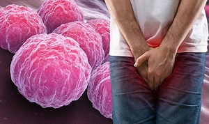 NHS: Expert gives advice on treatment of chlamydia