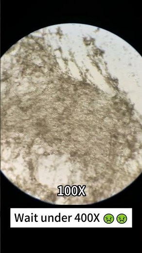 Raw Egg Under the Microscope: Mind-Blowing Science Experiment! #egg #food #microscope