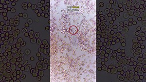 White Blood Cell Fights GIANT GERM!