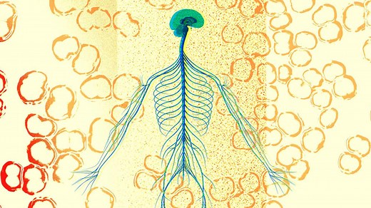 Bacterial Meningitis Is Serious, but You Can Reduce Your Risk