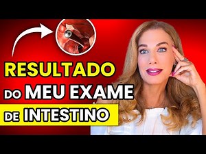MEU EXAME de COLONOSCOPIA: Como é o PREPARO, PARA QUE SERVE e os MEUS RESULTADOS | Carina Palatnik