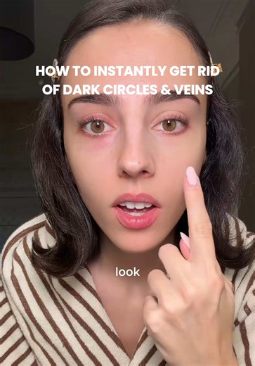 Effective Tips to Eliminate Dark Circles and Veins