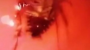 Distressing Content: Live cockroach pulled from woman's nose