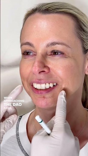 What Causes a Down Turned Smile?