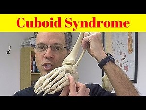 Cuboid Syndrome: Mysterious Foot Pain