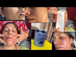 Full face waxing by Gel base liposoluable wax / Facial hair removal tutorial #skincare #facewaxing 😭