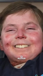 John lives with epidermolysis bullosa, a condition that leaves his body covered with open sores. He has over half his skin and is constantly battling severe pain. John still finds hope in serving as an example for others that it is possible to survive difficult times. ✅ FOLLOW @alpha_leaders for more Video - specialbooksbyspecialkids on YouTube | Leaders Community