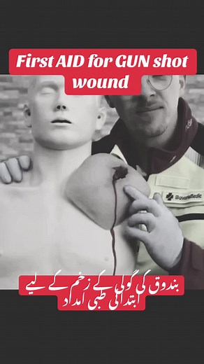 First Aid for Gunshot Wounds: Essential Steps