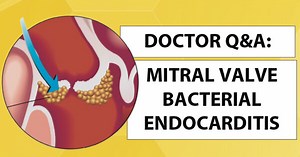Bacterial Endocarditis: What Should Heart Valve Patients Know?