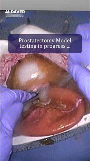 Prostatectomy Simulation Model Testing