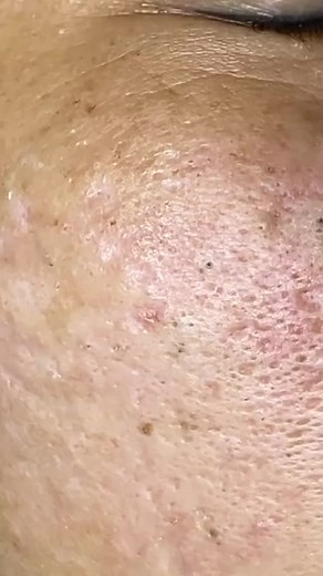 pointsnoir sur TikTok