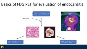 Updates in Evaluation and Management of Endocarditis