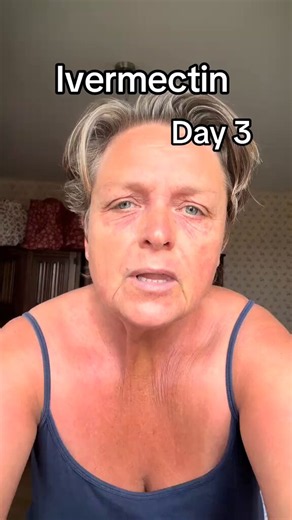 This is what you get when you don’t take the Ivermectin paste with binders.Taking oral Ivermectin (paste), no binders. At that stage, the flakiness in your eyes would be swollen. The first stage: burning face, and skin will feel raw, and every time you wash your face, it comes back.The skin flakes ooze and itch when washing it, giving the reaction in a way that makes you feel like liquid will come out of your cheeks.This will take 7–8 months to start getting better. Full recovery will take about