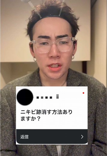 クレーター肌のニキビケア徹底ガイド