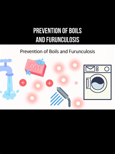 Prevention of boils and furunculosis #staph #furuncle #skininfection #boils #creatorsearchinsights