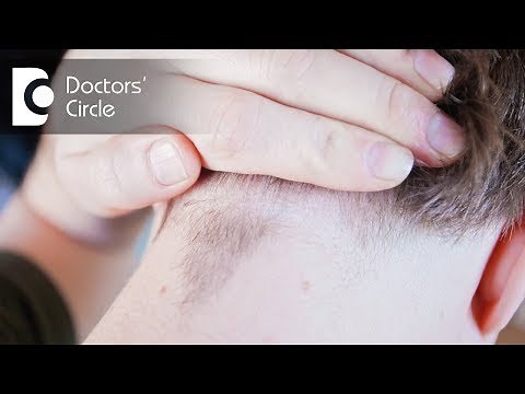 Management of scalp acne with radiating pain to back of head - Dr. Nischal K