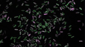 Automate your experiments with Guided Acquisition | ZEISS