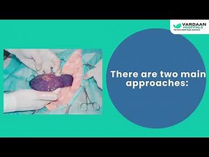 Spleen Removal Surgery