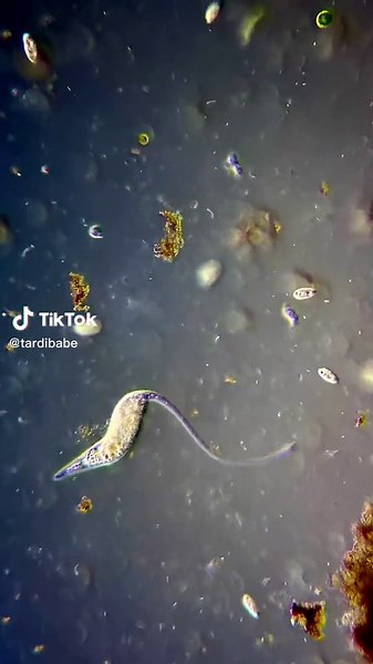 Single cell eats an amoeba! This gorgeous shape-shifting predator is...