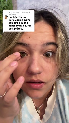 Custo de Prótese Ocular: Tudo que Você Precisa Saber