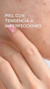 El primer sérum ecobiológico anti-imperfecciones y antiedad ya llego a Bioderma 💚 Prueba el NUEVO Sébium Sérum y descubre como recuperar el balance de tu piel, de la mano de la ecobiología 🙌✨️ #Biodermaperu #SebiumSerum #Ecobiologia | BIODERMA