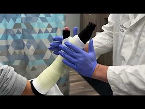 Short Arm Cast (Fiberglass)