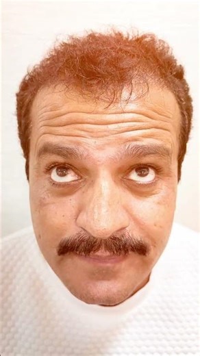 Advanced Botox for Deep Lines | Dr Amit Kerure, Navi Mumbai