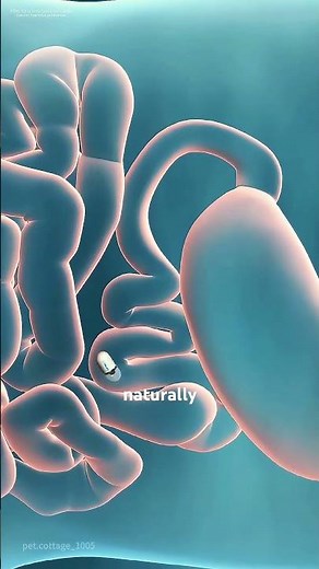 How Capsule Endoscopy Is Performed? (3D animation) #motivation #facts #epicmusicword #3danimation