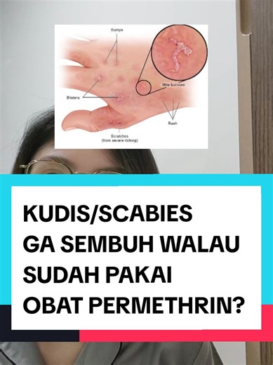 Mengapa Kudis/Scabies Tidak Sembuh Meski Pakai Permethrin?