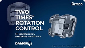 Damon™ Q2 is developed with you, the clinician in mind. With simplified mechanics, Damon Q2 provides over 2x improvement in rotation control. Here are some shots from our hands-on demos at AAO. Learn more: https://ormco.com/go/aao-damon-q2 | Ormco